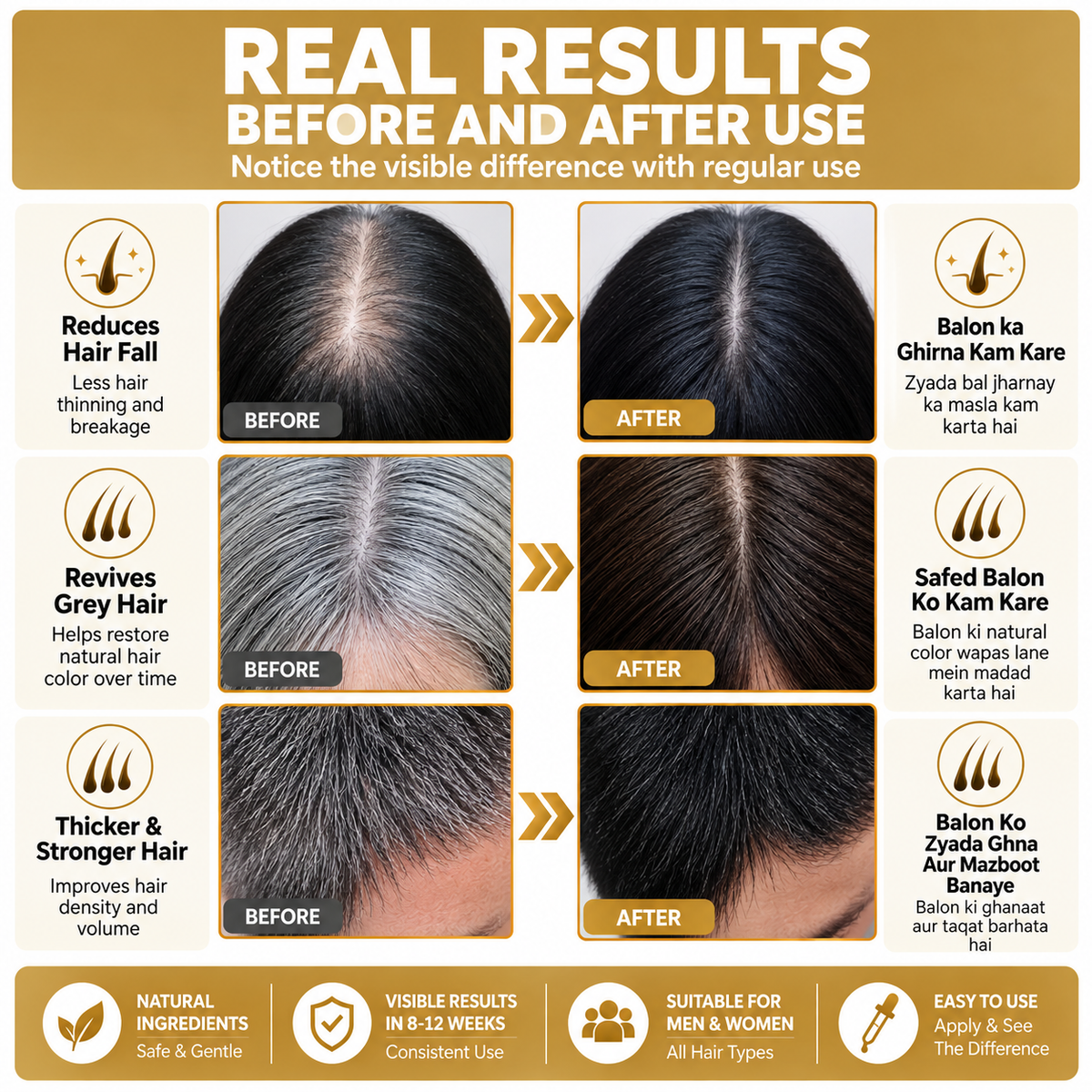 Proskire Hair Growth Serum – Hair Fall & Density Support