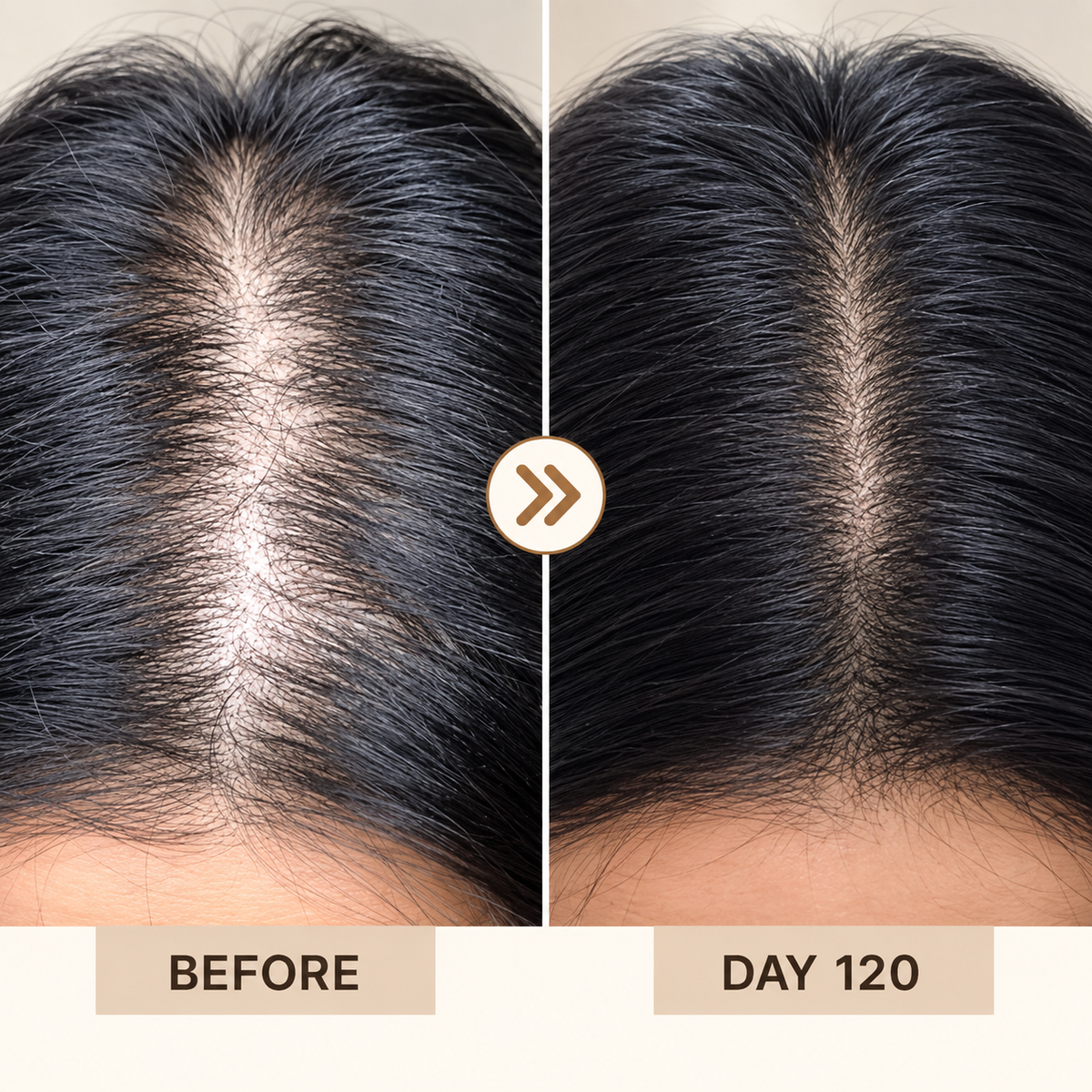 Proskire Hair Growth Serum – Hair Fall & Density Support