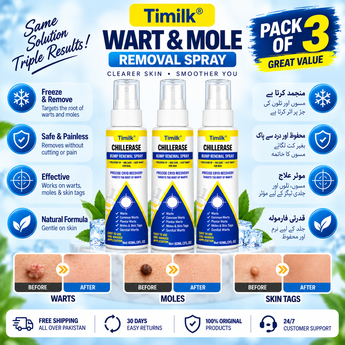 Timilk Wart & Mole Removal Spray
