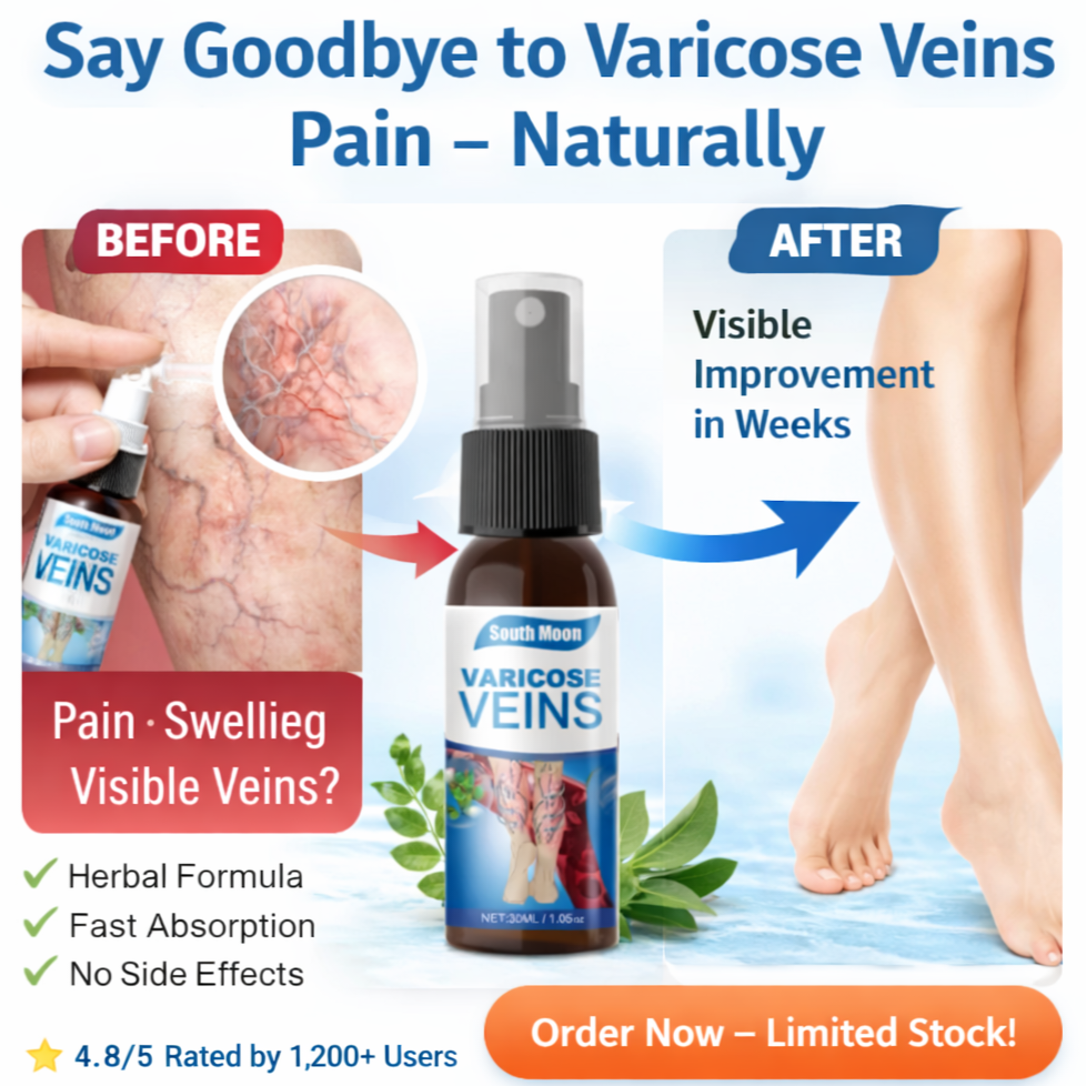 Varicose Veins Relief Spray – South Moon