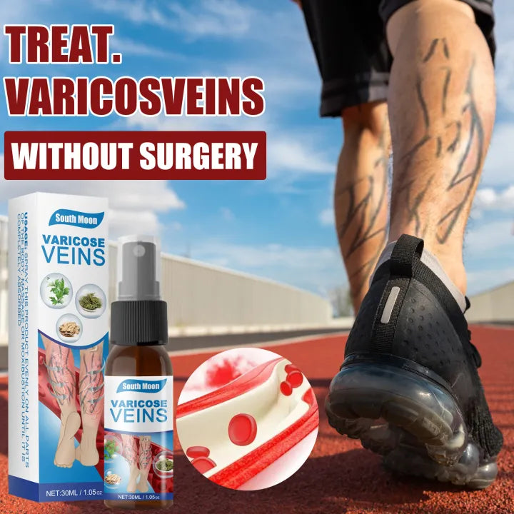 Varicose Veins Relief Spray – South Moon
